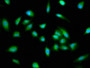 Immunofluorescence staining of Hela cells with CAC13159 at 1:100, counter-stained with DAPI. The cells were fixed in 4% formaldehyde, permeabilized using 0.2% Triton X-100 and blocked in 10% normal Goat Serum. The cells were then incubated with the antibody overnight at 4°C. The secondary antibody was Alexa Fluor 488-congugated AffiniPure Goat Anti-Rabbit IgG(H+L). Immunofluorescence staining of Hela cells with CAC13159 at 1:100, counter-stained with DAPI. The cells were fixed in 4% formaldehyde, permeabilized using 0.2% Triton X-100 and blocked in 10% normal Goat Serum. The cells were then incubated with the antibody overnight at 4°C. The secondary antibody was Alexa Fluor 488-congugated AffiniPure Goat Anti-Rabbit IgG(H+L).