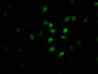 Immunofluorescence staining of U251 cells with CAC13159 at 1:100, counter-stained with DAPI. The cells were fixed in 4% formaldehyde, permeabilized using 0.2% Triton X-100 and blocked in 10% normal Goat Serum. The cells were then incubated with the antibody overnight at 4°C. The secondary antibody was Alexa Fluor 488-congugated AffiniPure Goat Anti-Rabbit IgG(H+L). Immunofluorescence staining of U251 cells with CAC13159 at 1:100, counter-stained with DAPI. The cells were fixed in 4% formaldehyde, permeabilized using 0.2% Triton X-100 and blocked in 10% normal Goat Serum. The cells were then incubated with the antibody overnight at 4°C. The secondary antibody was Alexa Fluor 488-congugated AffiniPure Goat Anti-Rabbit IgG(H+L).