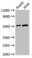 Western Blot, Positive WB detected in: HepG2 whole cell lysate, A549 whole cell lysate, All lanes: PNLIPRP2 antibody at 3ug/ml, Secondary, Goat polyclonal to rabbit IgG at 1/50000 dilution, Predicted band size: 52 kDa, Observed band size: 52 kDa Western Blot, Positive WB detected in: HepG2 whole cell lysate, A549 whole cell lysate, All lanes: PNLIPRP2 antibody at 3ug/ml, Secondary, Goat polyclonal to rabbit IgG at 1/50000 dilution, Predicted band size: 52 kDa, Observed band size: 52 kDa