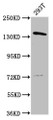 Western Blot, Positive WB detected in: 293T whole cell lysate, All lanes: POLG antibody at 4.7ug/ml, Secondary, Goat polyclonal to rabbit IgG at 1/50000 dilution, Predicted band size: 140 kDa, Observed band size: 140 kDa
