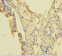 Immunohistochemistry of paraffin-embedded human lung tissue using CAC13165 at dilution of 1:100 Immunohistochemistry of paraffin-embedded human lung tissue using CAC13165 at dilution of 1:100