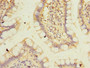 Immunohistochemistry of paraffin-embedded human small intestine tissue using CAC13167 at dilution of 1:100 Immunohistochemistry of paraffin-embedded human small intestine tissue using CAC13167 at dilution of 1:100