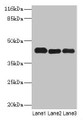 Western Blot, All lanes: PPME1 antibody at 2ug/ml, Lane 1: A549 whole cell lysate, Lane 2: Hela whole cell lysate, Lane 3: Mouse brain tissue, Secondary, Goat polyclonal to rabbit IgG at 1/10000 dilution, Predicted band size: 43, 23, 19, 44 kDa, Observed band size: 43 kDa