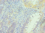 Immunohistochemistry of paraffin-embedded human epityphlon tissue using CAC13171 at dilution of 1:100