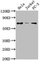 Western Blot, Positive WB detected in: Hela whole cell lysate, Jurkat whole cell lysate, PC-3 whole cell lysate, All lanes: PRICKLE3 antibody at 1:2000, Secondary, Goat polyclonal to rabbit IgG at 1/50000 dilution, Predicted band size: 69, 60 kDa, Observed band size: 69 kDa Western Blot, Positive WB detected in: Hela whole cell lysate, Jurkat whole cell lysate, PC-3 whole cell lysate, All lanes: PRICKLE3 antibody at 1:2000, Secondary, Goat polyclonal to rabbit IgG at 1/50000 dilution, Predicted band size: 69, 60 kDa, Observed band size: 69 kDa