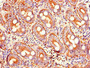 Immunohistochemistry of paraffin-embedded human small intestine tissue using CAC13174 at dilution of 1:100 Immunohistochemistry of paraffin-embedded human small intestine tissue using CAC13174 at dilution of 1:100
