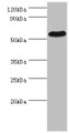 Western Blot, All lanes: PSEN1 antibody at 2ug/ml + Hela whole cell lysate, Secondary, Goat polyclonal to rabbit IgG at 1/10000 dilution, Predicted band size: 53, 43, 22, 47, 49 kDa, Observed band size: 53 kDa Western Blot, All lanes: PSEN1 antibody at 2ug/ml + Hela whole cell lysate, Secondary, Goat polyclonal to rabbit IgG at 1/10000 dilution, Predicted band size: 53, 43, 22, 47, 49 kDa, Observed band size: 53 kDa