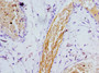 Immunohistochemistry of paraffin-embedded human epityphlon tissue using CAC13176 at dilution of 1:100 Immunohistochemistry of paraffin-embedded human epityphlon tissue using CAC13176 at dilution of 1:100