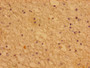 Immunohistochemistry of paraffin-embedded human brain tissue using CAC13178 at dilution of 1:100