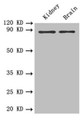 Western blotAll lanes: PTPRE antibody at 0.6 ug/mlLane 1: Mouse kidney tissueLane 2: Mouse brain tissueSecondaryGoat polyclonal to rabbit IgG at 1/10000 dilutionPredicted band size: 81, 75, 72 kDaObserved band size: 81 kDa Western blotAll lanes: PTPRE antibody at 0.6 ug/mlLane 1: Mouse kidney tissueLane 2: Mouse brain tissueSecondaryGoat polyclonal to rabbit IgG at 1/10000 dilutionPredicted band size: 81, 75, 72 kDaObserved band size: 81 kDa