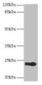 Western Blot, All lanes: RCVRN antibody at 2ug/ml + Mouse eye tissue, Secondary, Goat polyclonal to rabbit IgG at 1/10000 dilution, Predicted band size: 24 kDa, Observed band size: 24 kDa Western Blot, All lanes: RCVRN antibody at 2ug/ml + Mouse eye tissue, Secondary, Goat polyclonal to rabbit IgG at 1/10000 dilution, Predicted band size: 24 kDa, Observed band size: 24 kDa