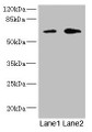 Western Blot, All lanes: REC8 antibody at 1.67ug/ml, Lane 1: Jurkat whole cell lysate, Lane 2: HT29 whole cell lysate, Secondary, Goat polyclonal to rabbit IgG at 1/10000 dilution, Predicted band size: 63, 61 kDa, Observed band size: 63 kDa Western Blot, All lanes: REC8 antibody at 1.67ug/ml, Lane 1: Jurkat whole cell lysate, Lane 2: HT29 whole cell lysate, Secondary, Goat polyclonal to rabbit IgG at 1/10000 dilution, Predicted band size: 63, 61 kDa, Observed band size: 63 kDa