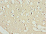Immunohistochemistry of paraffin-embedded human brain tissue using CAC13186 at dilution of 1:100