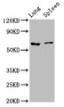 Western Blot, Positive WB detected in: Rat lung tissue, Rat spleen tissue, All lanes: RIPK2 antibody at 2.7ug/ml, Secondary, Goat polyclonal to rabbit IgG at 1/50000 dilution, Predicted band size: 62, 46 kDa, Observed band size: 62 kDa