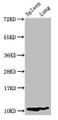 Western Blot, Positive WB detected in: Rat spleen tissue, Rat lung tissue, All lanes: S100a8 antibody at 3.2ug/ml, Secondary, Goat polyclonal to rabbit IgG at 1/50000 dilution, Predicted band size: 11 kDa, Observed band size: 11 kDa