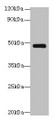 Western Blot, All lanes: Serpinh1 antibody at 6ug/ml + Jurkat whole cell lysate, Secondary, Goat polyclonal to rabbit IgG at 1/10000 dilution, Predicted band size: 47 kDa, Observed band size: 47 kDa