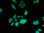 Immunofluorescent analysis of HepG2 cells using CAC13203 at dilution of 1:100 and Alexa Fluor 488-congugated AffiniPure Goat Anti-Rabbit IgG(H+L) Immunofluorescent analysis of HepG2 cells using CAC13203 at dilution of 1:100 and Alexa Fluor 488-congugated AffiniPure Goat Anti-Rabbit IgG(H+L)