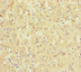 Immunohistochemistry of paraffin-embedded human liver tissue using CAC13204 at dilution of 1:100