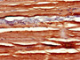 Immunohistochemistry of paraffin-embedded human skeletal muscle tissue using CAC13205 at dilution of 1:100