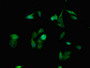 Immunofluorescent analysis of Hela cells using CAC13207 at dilution of 1:100 and Alexa Fluor 488-congugated AffiniPure Goat Anti-Rabbit IgG(H+L)