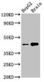 Western Blot, Positive WB detected in: HepG2 whole cell lysate, Mouse brain tissue, All lanes: STK17B antibody at 3ug/ml, Secondary, Goat polyclonal to rabbit IgG at 1/50000 dilution, Predicted band size: 43 kDa, Observed band size: 43 kDa