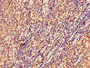 IHC image of CAC13210 diluted at 1:300 and staining in paraffin-embedded human lymph node tissue performed on a Leica BondTM system. After dewaxing and hydration, antigen retrieval was mediated by high pressure in a citrate buffer (pH 6.0). Section was blocked with 10% normal goat serum 30min at RT. Then primary antibody (1% BSA) was incubated at 4°C overnight. The primary is detected by a biotinylated secondary antibody and visualized using an HRP conjugated SP system.