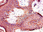 Immunohistochemistry of paraffin-embedded human skin tissue using CAC13213 at dilution of 1:100
