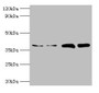 Western Blot, All lanes: TBCC antibody at 2ug/ml, Lane 1: Hela whole cell lysate, Lane 2: HepG2 whole cell lysate, Lane 3: A549 whole cell lysate, Lane 4: MCF-7 whole cell lysate, Secondary, Goat polyclonal to rabbit IgG at 1/10000 dilution, Predicted band size: 40 kDa, Observed band size: 40 kDa