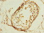 Immunohistochemistry of paraffin-embedded human testis tissue using CAC13222 at dilution of 1:100 Immunohistochemistry of paraffin-embedded human testis tissue using CAC13222 at dilution of 1:100