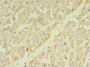 Immunohistochemistry of paraffin-embedded human heart tissue using CAC13224 at dilution of 1:100