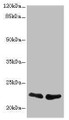Western Blot, All lanes: TNFAIP8 antibody at 2.32ug/ml, Lane 1: A431 whole cell lysate, Lane 2: PC-3 whole cell lysate, Secondary, Goat polyclonal to rabbit IgG at 1/10000 dilution, Predicted band size: 24, 23, 22, 25 kDa, Observed band size: 22 kDa