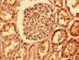 IHC image of CAC13229 diluted at 1:400 and staining in paraffin-embedded human kidney tissue performed on a Leica BondTM system. After dewaxing and hydration, antigen retrieval was mediated by high pressure in a citrate buffer (pH 6.0). Section was blocked with 10% normal goat serum 30min at RT. Then primary antibody (1% BSA) was incubated at 4°C overnight. The primary is detected by a biotinylated secondary antibody and visualized using an HRP conjugated SP system.