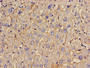 Immunohistochemistry of paraffin-embedded human liver tissue using CAC13230 at dilution of 1:100 Immunohistochemistry of paraffin-embedded human liver tissue using CAC13230 at dilution of 1:100