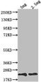 Western Blot, Positive WB detected in Recombinant protein, All lanes: TRBC2 antibody at 1:2000, Secondary, Goat polyclonal to rabbit IgG at 1/50000 dilution, Predicted band size: 19.7 kDa, Observed band size: 20 kDa