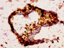 IHC image of CAC13238 diluted at 1:200 and staining in paraffin-embedded human testis tissue performed on a Leica BondTM system. After dewaxing and hydration, antigen retrieval was mediated by high pressure in a citrate buffer (pH 6.0). Section was blocked with 10% normal goat serum 30min at RT. Then primary antibody (1% BSA) was incubated at 4°C overnight. The primary is detected by a biotinylated secondary antibody and visualized using an HRP conjugated SP system. IHC image of CAC13238 diluted at 1:200 and staining in paraffin-embedded human testis tissue performed on a Leica BondTM system. After dewaxing and hydration, antigen retrieval was mediated by high pressure in a citrate buffer (pH 6.0). Section was blocked with 10% normal goat serum 30min at RT. Then primary antibody (1% BSA) was incubated at 4°C overnight. The primary is detected by a biotinylated secondary antibody and visualized using an HRP conjugated SP system.
