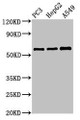 Western Blot, Positive WB detected in: PC-3 whole cell lysate, HepG2 whole cell lysate, A549 whole cell lysate, All lanes: vnn1 antibody at 3.4ug/ml, Secondary, Goat polyclonal to rabbit IgG at 1/50000 dilution, Predicted band size: 58 kDa, Observed band size: 58 kDa Western Blot, Positive WB detected in: PC-3 whole cell lysate, HepG2 whole cell lysate, A549 whole cell lysate, All lanes: vnn1 antibody at 3.4ug/ml, Secondary, Goat polyclonal to rabbit IgG at 1/50000 dilution, Predicted band size: 58 kDa, Observed band size: 58 kDa
