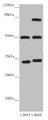 Western Blot, All lanes: TUBA1B antibody at 12 ug/ml, Lane 1: Mouse brain tissue, Lane 2: Mouse liver tissue, Secondary, Goat polyclonal to rabbit IgG at 1/10000 dilution, Predicted band size: 51, 38 kDa, Observed band size: 51, 34, 75 kDa Western Blot, All lanes: TUBA1B antibody at 12 ug/ml, Lane 1: Mouse brain tissue, Lane 2: Mouse liver tissue, Secondary, Goat polyclonal to rabbit IgG at 1/10000 dilution, Predicted band size: 51, 38 kDa, Observed band size: 51, 34, 75 kDa