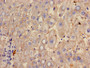 Immunohistochemistry of paraffin-embedded human liver tissue using CAC13269 at dilution of 1:100 Immunohistochemistry of paraffin-embedded human liver tissue using CAC13269 at dilution of 1:100