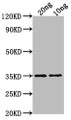 Western Blot, Positive WB detected in Recombinant protein, All lanes: WRKY47 antibody at 1:2000, Secondary, Goat polyclonal to rabbit IgG at 1/50000 dilution, Predicted band size: 35.7 kDa, Observed band size: 35 kDa Western Blot, Positive WB detected in Recombinant protein, All lanes: WRKY47 antibody at 1:2000, Secondary, Goat polyclonal to rabbit IgG at 1/50000 dilution, Predicted band size: 35.7 kDa, Observed band size: 35 kDa