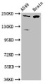 Western Blot, Positive WB detected in: A549 whole cell lysate, Rat brain tissue, All lanes: CABIN1 antibody at 3.1ug/ml, Secondary, Goat polyclonal to rabbit IgG at 1/50000 dilution, Predicted band size: 247, 238 kDa, Observed band size: 247 kDa Western Blot, Positive WB detected in: A549 whole cell lysate, Rat brain tissue, All lanes: CABIN1 antibody at 3.1ug/ml, Secondary, Goat polyclonal to rabbit IgG at 1/50000 dilution, Predicted band size: 247, 238 kDa, Observed band size: 247 kDa