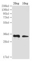 Western Blot, Positive WB detected in Recombinant protein, All lanes: A27L antibody at 1:2000, Secondary, Goat polyclonal to rabbit IgG at 1/50000 dilution, Predicted band size: 31 kDa, Observed band size: 31 kDa Western Blot, Positive WB detected in Recombinant protein, All lanes: A27L antibody at 1:2000, Secondary, Goat polyclonal to rabbit IgG at 1/50000 dilution, Predicted band size: 31 kDa, Observed band size: 31 kDa