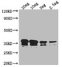 Western Blot, Positive WB detected in Recombinant protein, All lanes: RCSF antibody at 1:2000, Secondary, Goat polyclonal to rabbit IgG at 1/50000 dilution, Predicted band size: 39.3 kDa, Observed band size: 37 kDa Western Blot, Positive WB detected in Recombinant protein, All lanes: RCSF antibody at 1:2000, Secondary, Goat polyclonal to rabbit IgG at 1/50000 dilution, Predicted band size: 39.3 kDa, Observed band size: 37 kDa