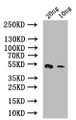 Western Blot, Positive WB detected in: recombinant protein, All lanes: psaA Antibody at 1:1000, Secondary, Goat polyclonal to rabbit IgG at 1/50000 dilution, Predicted band size: 42 kDa, Observed band size: 42 kDa Western Blot, Positive WB detected in: recombinant protein, All lanes: psaA Antibody at 1:1000, Secondary, Goat polyclonal to rabbit IgG at 1/50000 dilution, Predicted band size: 42 kDa, Observed band size: 42 kDa