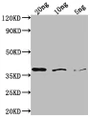 Western Blot, Positive WB detected in Recombinant protein, All lanes: bamA antibody at 1:2000, Secondary, Goat polyclonal to rabbit IgG at 1/50000 dilution, Predicted band size: 36 kDa, Observed band size: 38 kDa