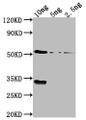 Western Blot, Positive WB detected in Recombinant protein, All lanes: OXYR antibody at 1:2000, Secondary, Goat polyclonal to rabbit IgG at 1/50000 dilution, Predicted band size: 53.6 kDa, Observed band size: 54 kDa Western Blot, Positive WB detected in Recombinant protein, All lanes: OXYR antibody at 1:2000, Secondary, Goat polyclonal to rabbit IgG at 1/50000 dilution, Predicted band size: 53.6 kDa, Observed band size: 54 kDa