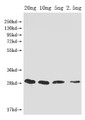 Western Blot, Positive WB detected in Recombinant protein, All lanes: mazF antibody at 1:2000, Secondary, Goat polyclonal to rabbit IgG at 1/50000 dilution, Predicted band size: 29 kDa, Observed band size: 29 kDa Western Blot, Positive WB detected in Recombinant protein, All lanes: mazF antibody at 1:2000, Secondary, Goat polyclonal to rabbit IgG at 1/50000 dilution, Predicted band size: 29 kDa, Observed band size: 29 kDa
