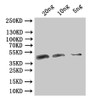 Western Blot, Positive WB detected in: recombinant protein, All lanes:VACWR106 Antibody at 1:1000, Secondary, Goat polyclonal to rabbit IgG at 1/50000 dilution, Predicted band size: 40.2 kDa, Observed band size: 41 kDa Western Blot, Positive WB detected in: recombinant protein, All lanes:VACWR106 Antibody at 1:1000, Secondary, Goat polyclonal to rabbit IgG at 1/50000 dilution, Predicted band size: 40.2 kDa, Observed band size: 41 kDa