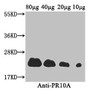 Western Blot, Positive WB detected in: Coptis japonica (80ug, 40ug, 20ug, 10ug), All lanes: PR10A antibody at 3.4ug/ml, Secondary, Goat polyclonal to rabbit IgG at 1/50000 dilution, Predicted band size: 23 kDa, Observed band size: 23 kDa Western Blot, Positive WB detected in: Coptis japonica (80ug, 40ug, 20ug, 10ug), All lanes: PR10A antibody at 3.4ug/ml, Secondary, Goat polyclonal to rabbit IgG at 1/50000 dilution, Predicted band size: 23 kDa, Observed band size: 23 kDa