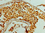 Immunohistochemistry of paraffin-embedded human testis tissue using CAC13334 at dilution of 1:100 Immunohistochemistry of paraffin-embedded human testis tissue using CAC13334 at dilution of 1:100
