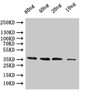 Western Blot, Positive WB detected in: recombinant protein, All lanes:coat Antibody at 1:1000, Secondary, Goat polyclonal to rabbit IgG at 1/50000 dilution, Predicted band size: 37.8 kDa, Observed band size: 38 kDa Western Blot, Positive WB detected in: recombinant protein, All lanes:coat Antibody at 1:1000, Secondary, Goat polyclonal to rabbit IgG at 1/50000 dilution, Predicted band size: 37.8 kDa, Observed band size: 38 kDa